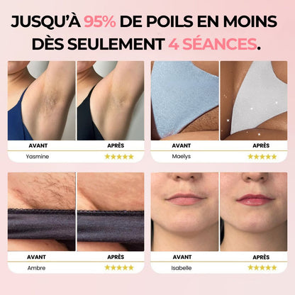 IPL Pulse Épilateur IPL